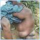 10 Weirdest Diseases In World (Pics)